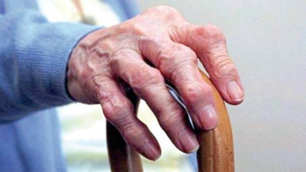 تعرف على علامات التهاب المفاصل الروماتويدي